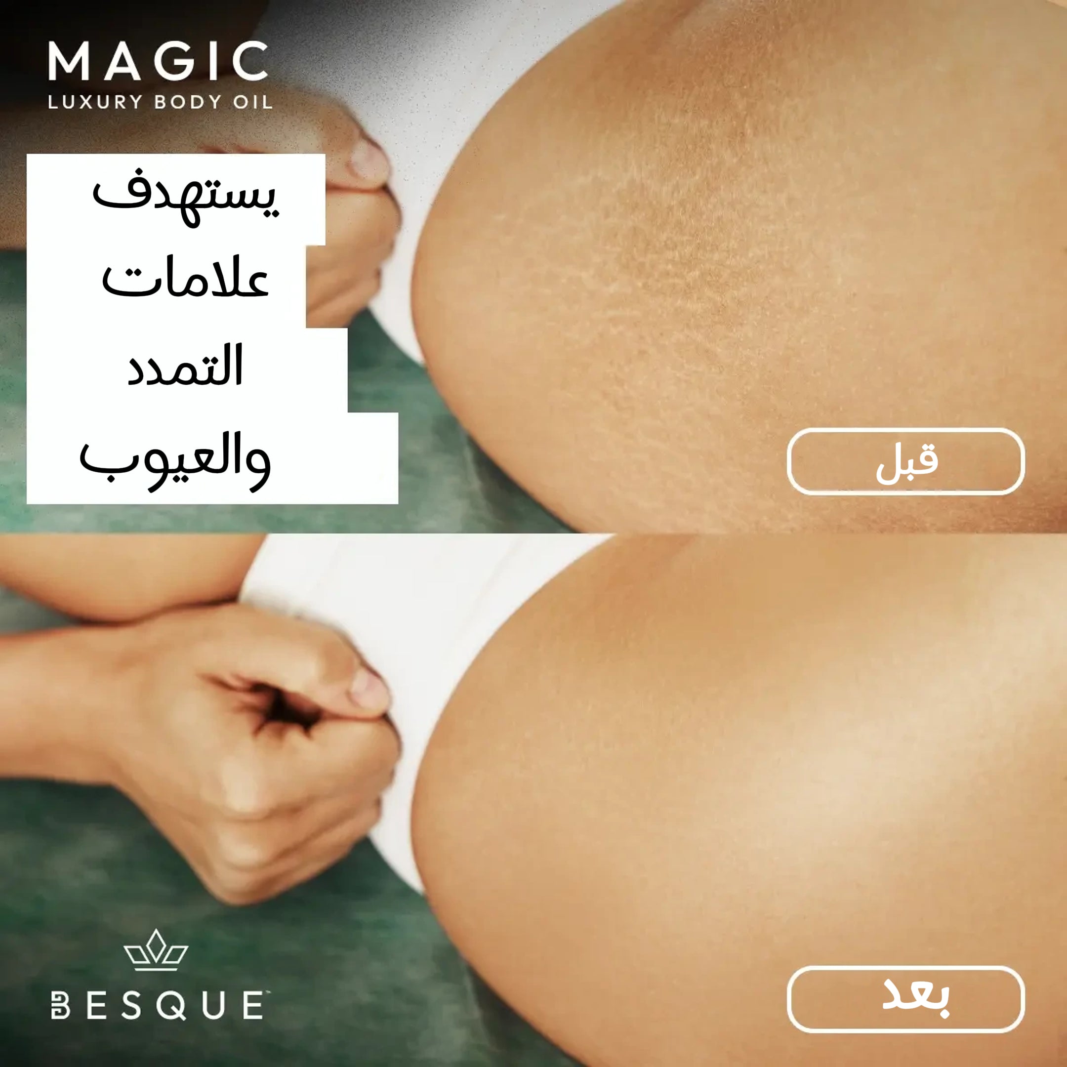 زيت الجسم ماجيك - لبشرة مشدودة ومشرقة