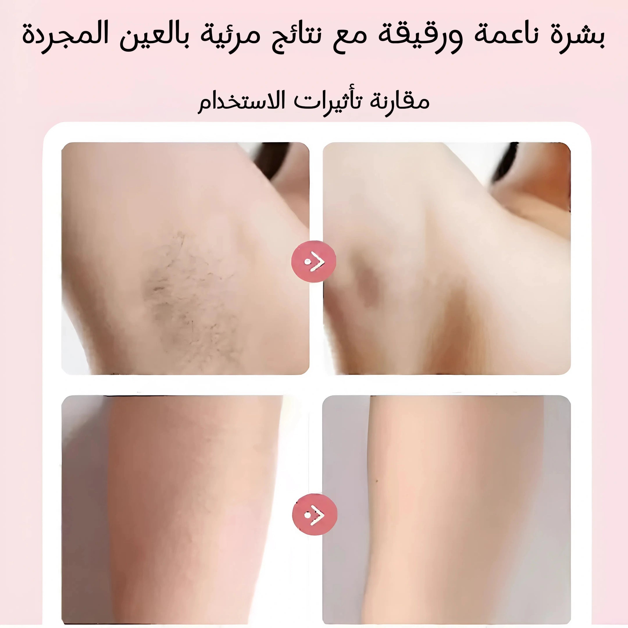 جهاز  إزالة الشعر الوجه