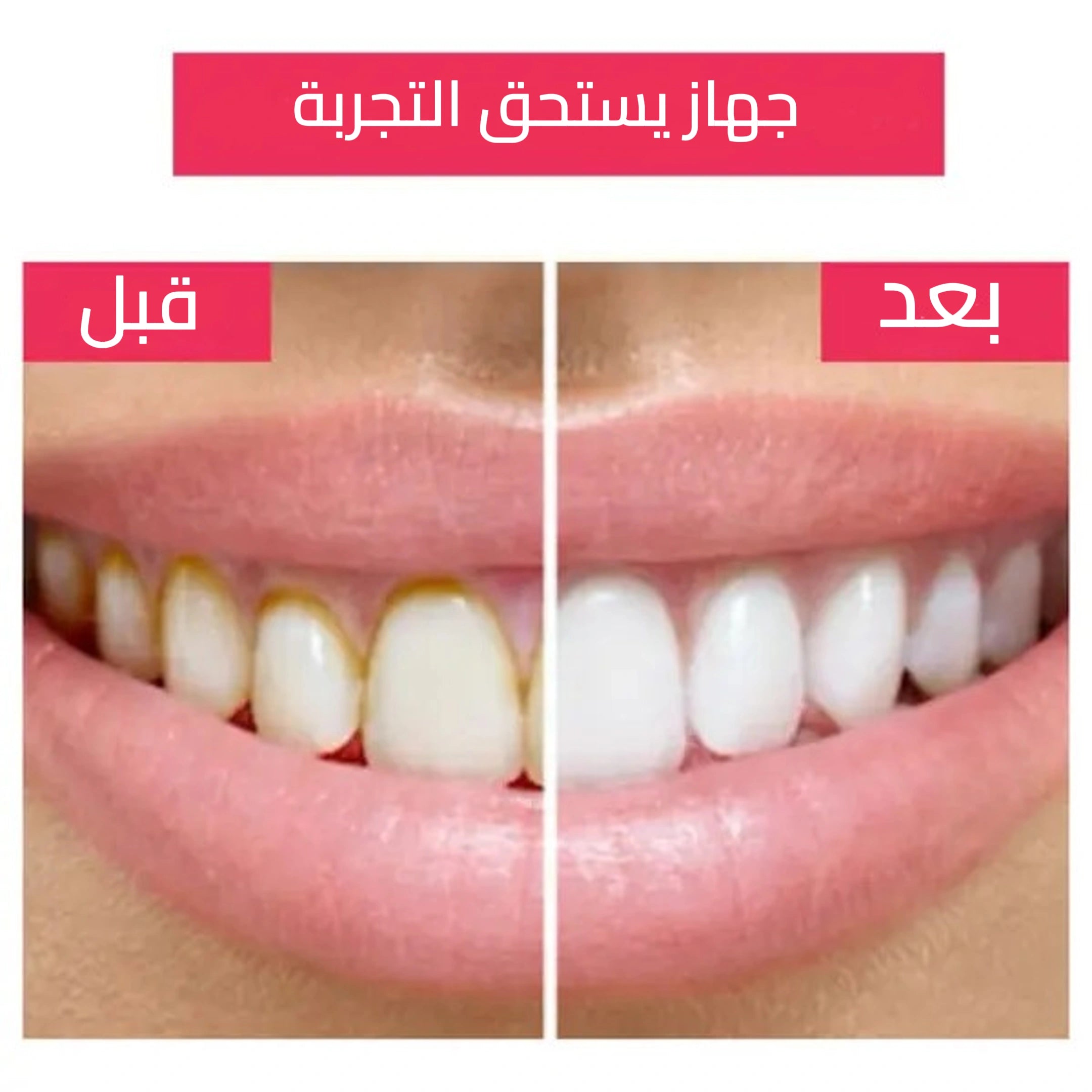 ملحق أسنان لإزالة  البكتيريا