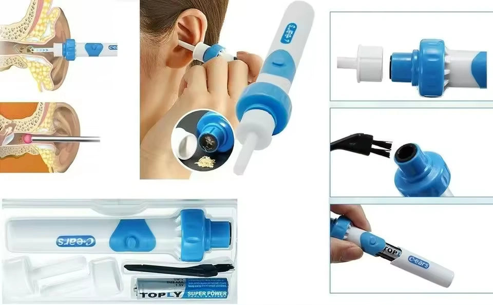 جهاز شفط شمع الأذن